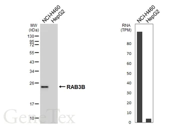 Anti-RAB3B antibody [HL6442] used in Western Blot (WB). GTX648890