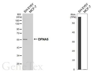 Anti-DFNA5 antibody [HL6448] used in Western Blot (WB). GTX648896