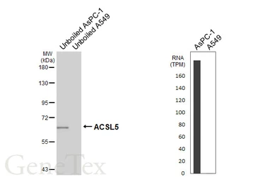 Anti-ACSL5 antibody [HL6450] used in Western Blot (WB). GTX648898