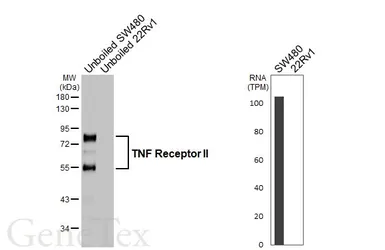 Anti-TNF Receptor II antibody [HL6463] used in Western Blot (WB). GTX648911