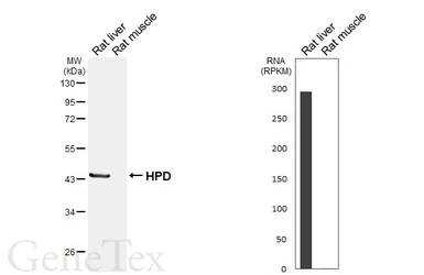 Anti-HPD antibody [HL6468] used in Western Blot (WB). GTX648916