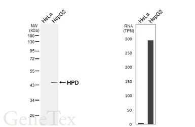Anti-HPD antibody [HL6468] used in Western Blot (WB). GTX648916