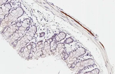 Anti-Peripherin antibody [HL6471] used in IHC (Paraffin sections) (IHC-P). GTX648919