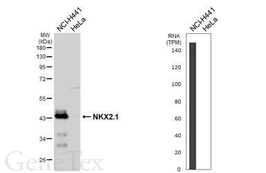 Anti-NKX2.1 antibody [HL6474] used in Western Blot (WB). GTX648922
