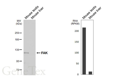 Anti-FAK antibody [HL6480] used in Western Blot (WB). GTX648928