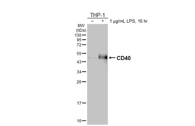 Anti-CD40 antibody [HL6485] used in Western Blot (WB). GTX648933