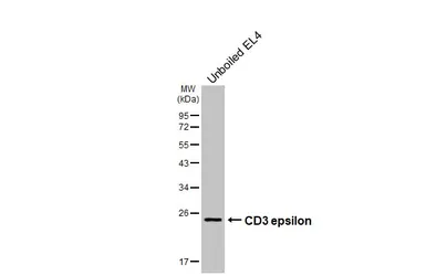 Anti-CD3 epsilon antibody [GT416] used in Western Blot (WB). GTX648937