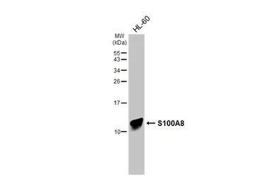 Anti-S100A8 antibody [HL6492] used in Western Blot (WB). GTX648948