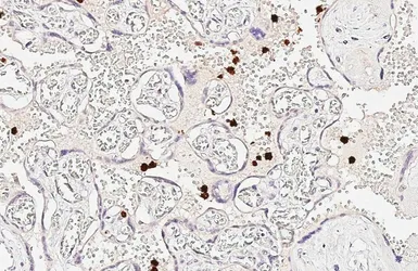 Anti-S100A8 antibody [HL6492] used in IHC (Paraffin sections) (IHC-P). GTX648948