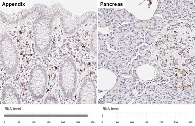 Anti-S100A8 antibody [HL6492] used in IHC (Paraffin sections) (IHC-P). GTX648948