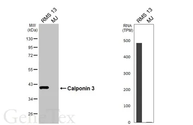 Anti-Calponin 3 antibody [HL6493] used in Western Blot (WB). GTX648949