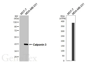 Anti-Calponin 3 antibody [HL6493] used in Western Blot (WB). GTX648949
