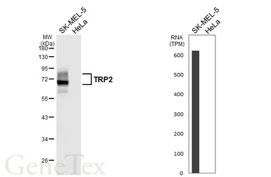 Anti-TRP2 antibody [HL6508] used in Western Blot (WB). GTX648964