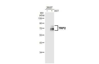 Anti-TRP2 antibody [HL6508] used in Western Blot (WB). GTX648964
