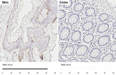 Anti-TRP2 antibody [HL6508] used in IHC (Paraffin sections) (IHC-P). GTX648964