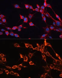 Anti-SLC25A24 antibody used in Immunocytochemistry/ Immunofluorescence (ICC/IF). GTX64897