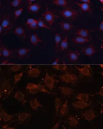Anti-SLC25A24 antibody used in Immunocytochemistry/ Immunofluorescence (ICC/IF). GTX64897