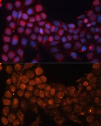 Anti-SLC25A24 antibody used in Immunocytochemistry/ Immunofluorescence (ICC/IF). GTX64897