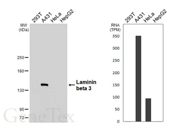 Anti-Laminin beta 3 antibody [HL6516] used in Western Blot (WB). GTX648972