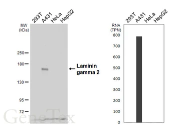 Anti-Laminin gamma 2 antibody [HL6517] used in Western Blot (WB). GTX648973