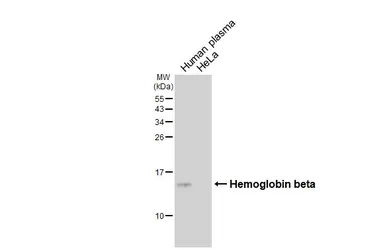 Anti-Hemoglobin beta antibody [HL6521] used in Western Blot (WB). GTX648977