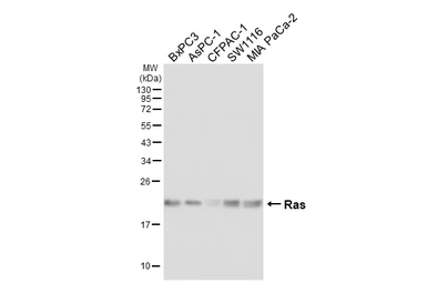 Anti-Ras antibody [HL6523] used in Western Blot (WB). GTX648979