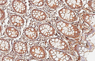 Anti-Ras antibody [HL6523] used in IHC (Paraffin sections) (IHC-P). GTX648979