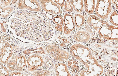 Anti-Ras antibody [HL6523] used in IHC (Paraffin sections) (IHC-P). GTX648979