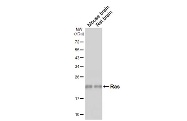 Anti-Ras antibody [HL6523] used in Western Blot (WB). GTX648979