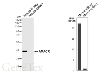 Anti-AMACR antibody [HL6548] used in Western Blot (WB). GTX649018