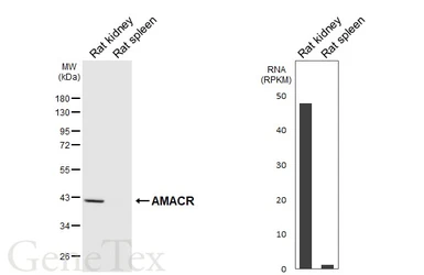 Anti-AMACR antibody [HL6548] used in Western Blot (WB). GTX649018