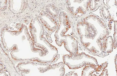 Anti-AMACR antibody [HL6548] used in IHC (Paraffin sections) (IHC-P). GTX649018