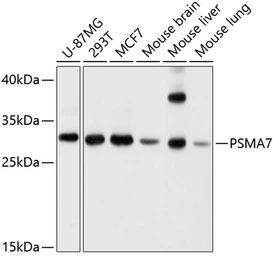 Anti-PSMA7 antibody used in Western Blot (WB). GTX64902