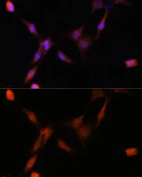 Anti-PSMA7 antibody used in Immunocytochemistry/ Immunofluorescence (ICC/IF). GTX64902