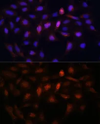 Anti-PSMA7 antibody used in Immunocytochemistry/ Immunofluorescence (ICC/IF). GTX64902