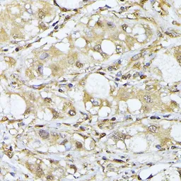 Anti-PSMA7 antibody used in IHC (Paraffin sections) (IHC-P). GTX64902