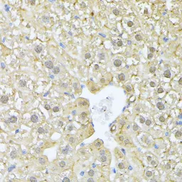 Anti-PSMA7 antibody used in IHC (Paraffin sections) (IHC-P). GTX64902