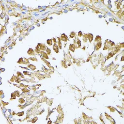 Anti-PSMA7 antibody used in IHC (Paraffin sections) (IHC-P). GTX64902