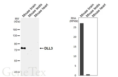 Anti-DLL3 antibody [HL6550] used in Western Blot (WB). GTX649020