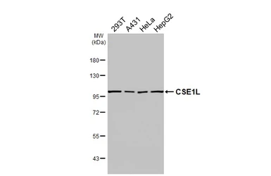 Anti-CSE1L antibody [HL6555] used in Western Blot (WB). GTX649025