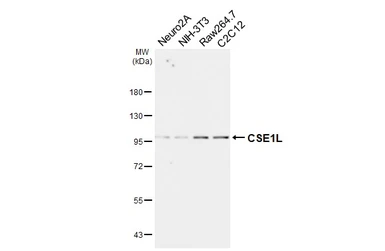 Anti-CSE1L antibody [HL6555] used in Western Blot (WB). GTX649025
