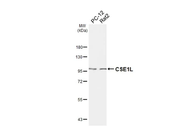 Anti-CSE1L antibody [HL6555] used in Western Blot (WB). GTX649025