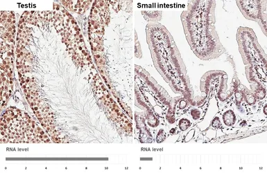 Anti-CSE1L antibody [HL6555] used in IHC (Paraffin sections) (IHC-P). GTX649025