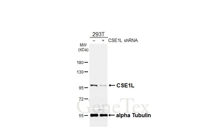 Anti-CSE1L antibody [HL6555] used in Western Blot (WB). GTX649025