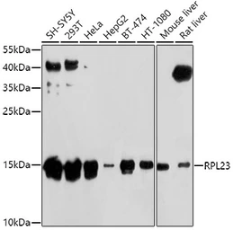 Anti-RPL23 antibody used in Western Blot (WB). GTX64903