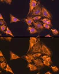Anti-RPL23 antibody used in Immunocytochemistry/ Immunofluorescence (ICC/IF). GTX64903