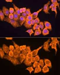 Anti-RPL23 antibody used in Immunocytochemistry/ Immunofluorescence (ICC/IF). GTX64903