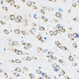 Anti-RPL23 antibody used in IHC (Paraffin sections) (IHC-P). GTX64903