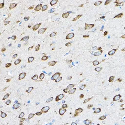 Anti-RPL23 antibody used in IHC (Paraffin sections) (IHC-P). GTX64903