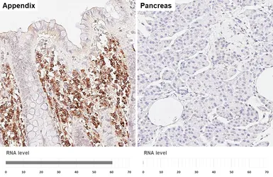 Anti-MZB1 antibody [HL6563] used in IHC (Paraffin sections) (IHC-P). GTX649033
